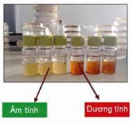 Hóa chất xét nghiệm liên cầu khuẩn nhóm B (GBS)